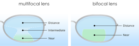 Multifocal or bifocal glasses for myopia control