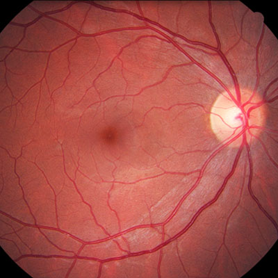 A retinal photograph is taken to check eye health and for any signs of disease.
